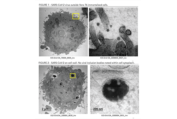 Further Evidence of Xylitol’s Effectiveness Against Viruses