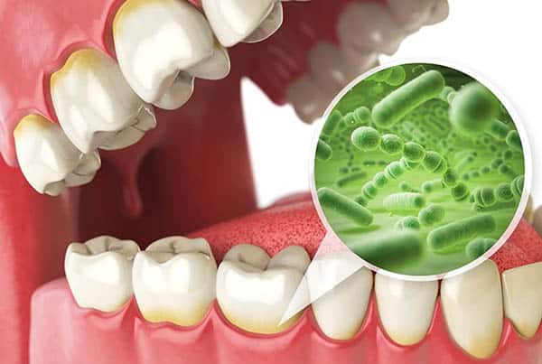 Effect of Xylitol on Various Oral bacteria