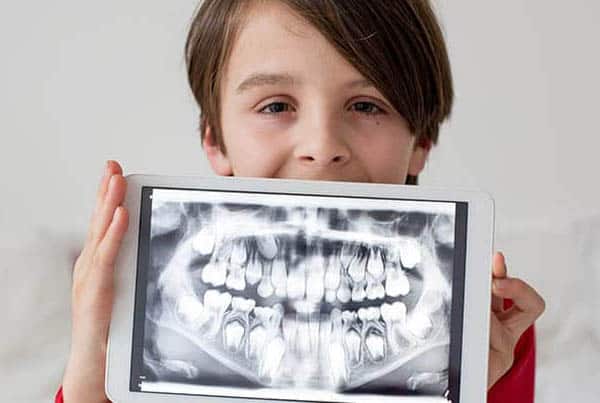 High-dose Xylitol in High-risk Caries Subjects
